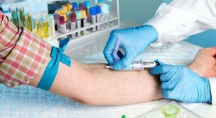 smoke and take a blood test from a vein