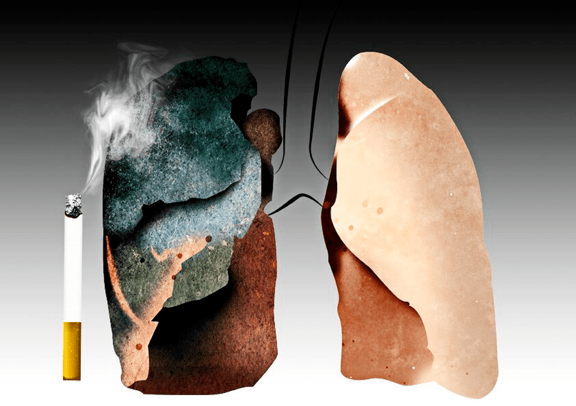 what smoking leads to